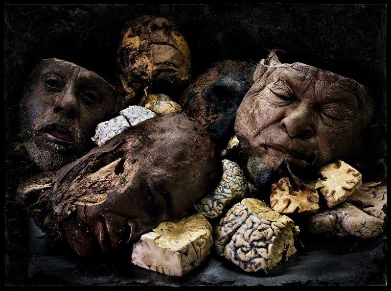 Фотографии останков человеческого тела от Джека Бурмана